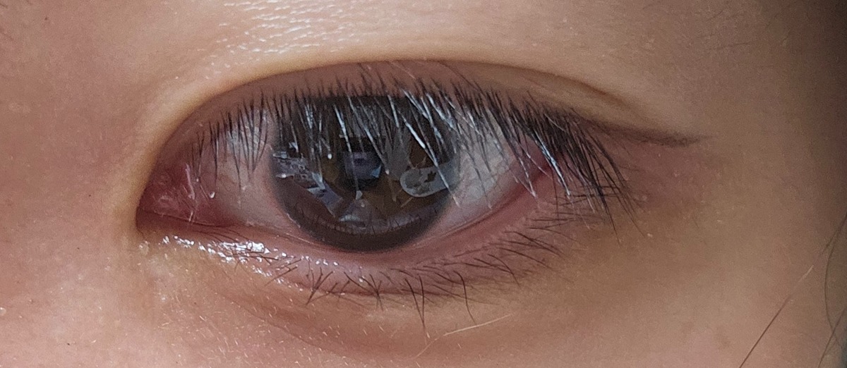 AgAbFD