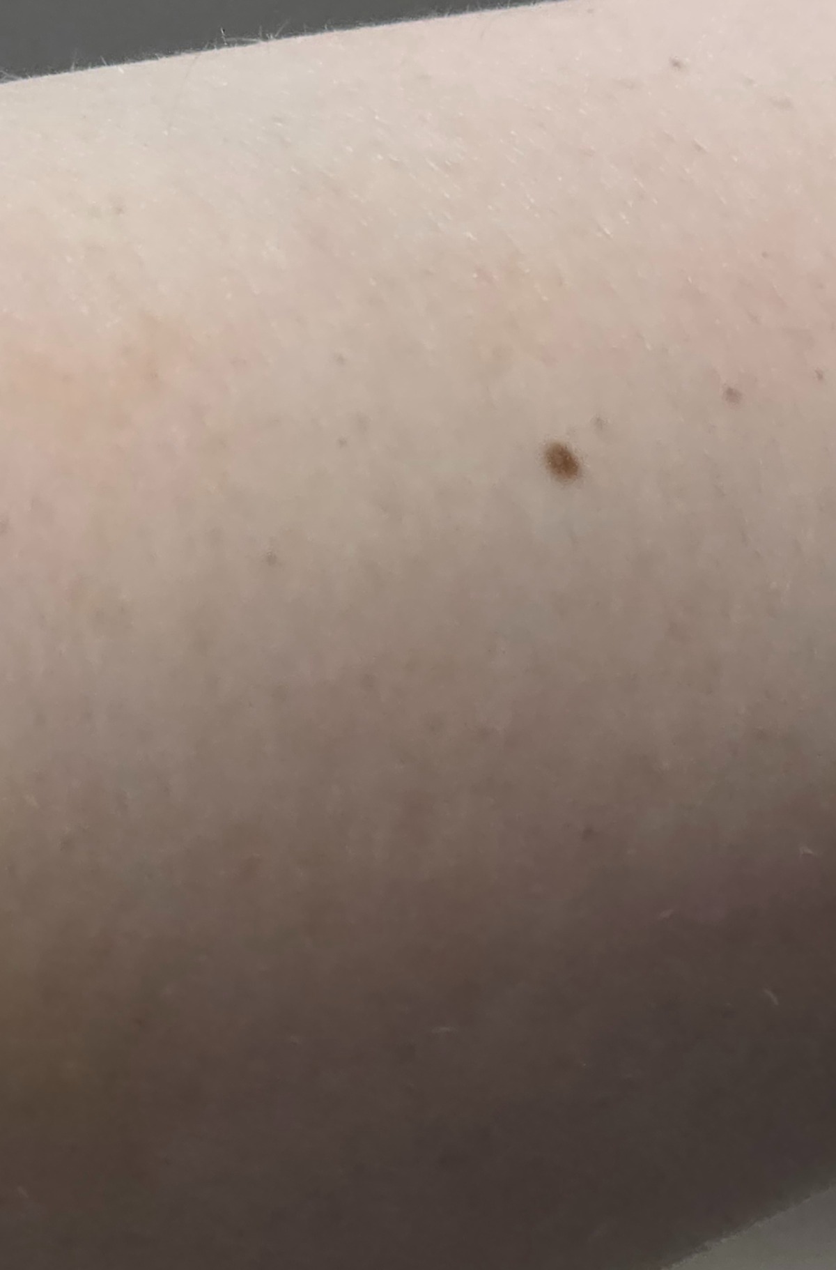 AvLcQm