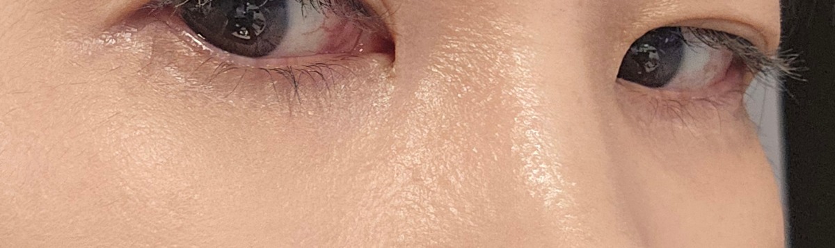 BPLbRt