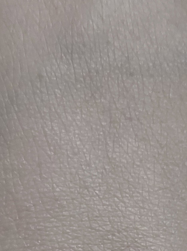 BtTKgC