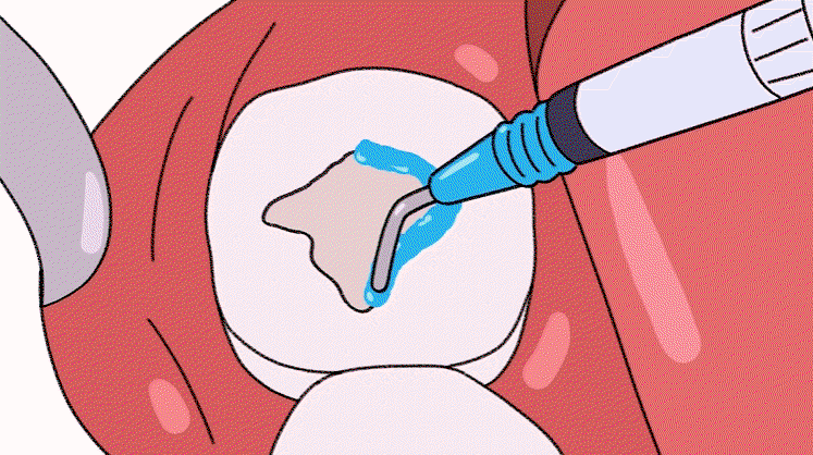 CCLQDW.gif