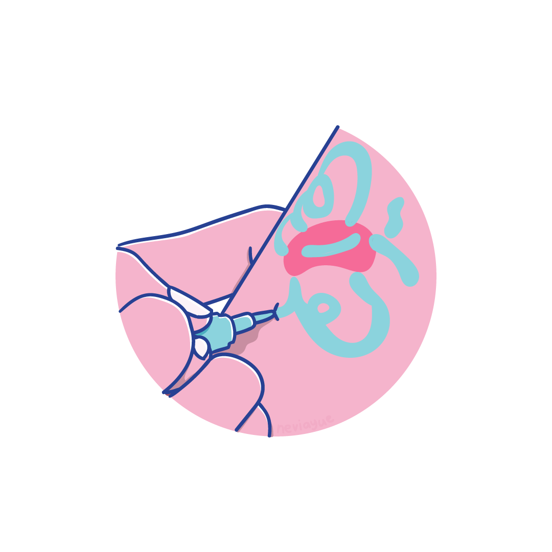 CUEwFa.gif