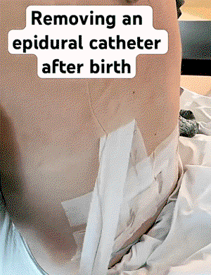 EUdGoL.gif