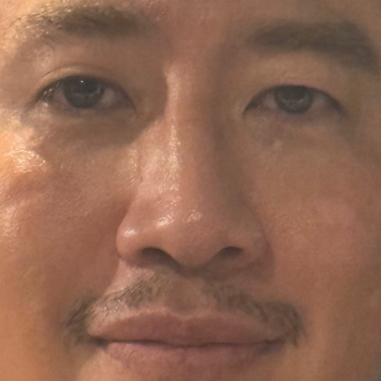 FRDGKo