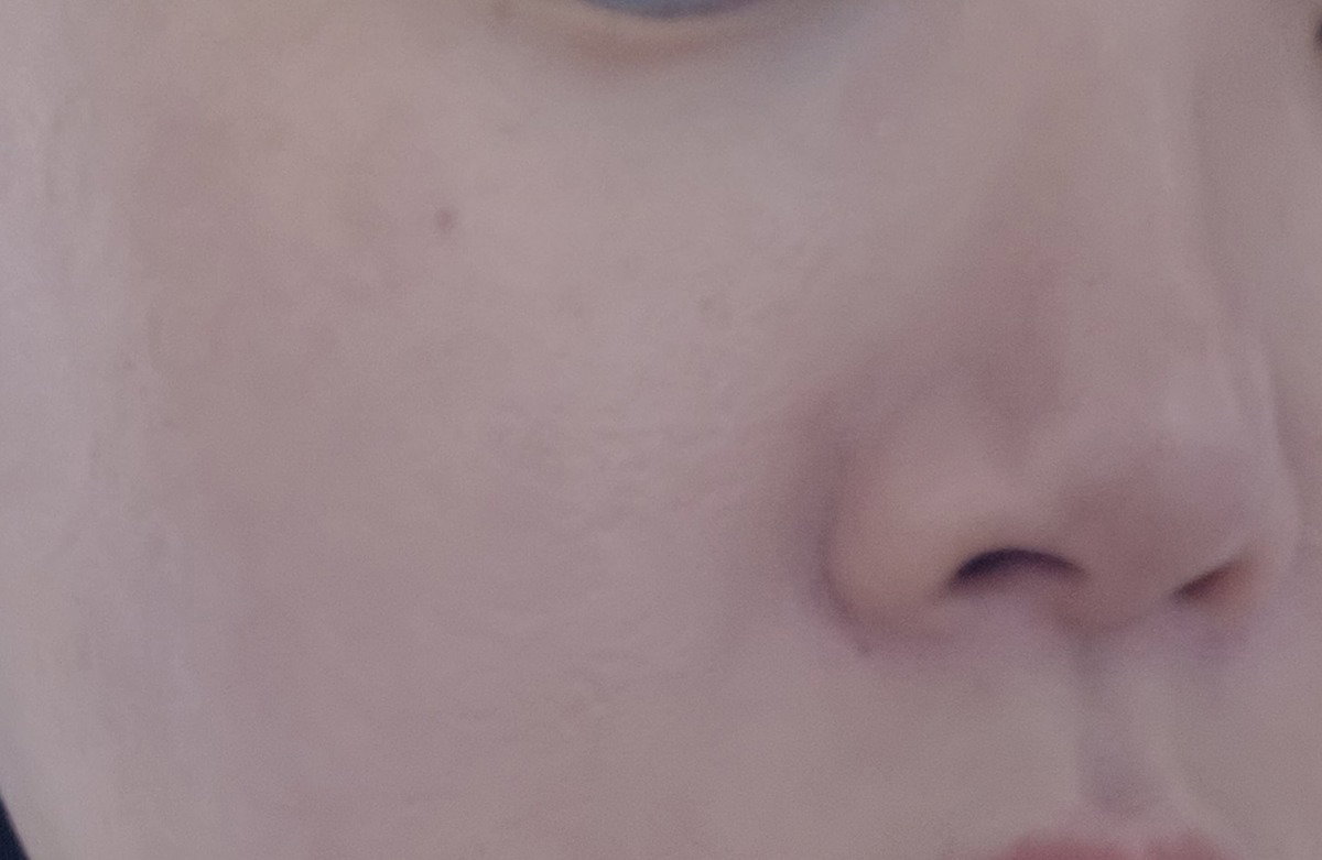 GLmntN