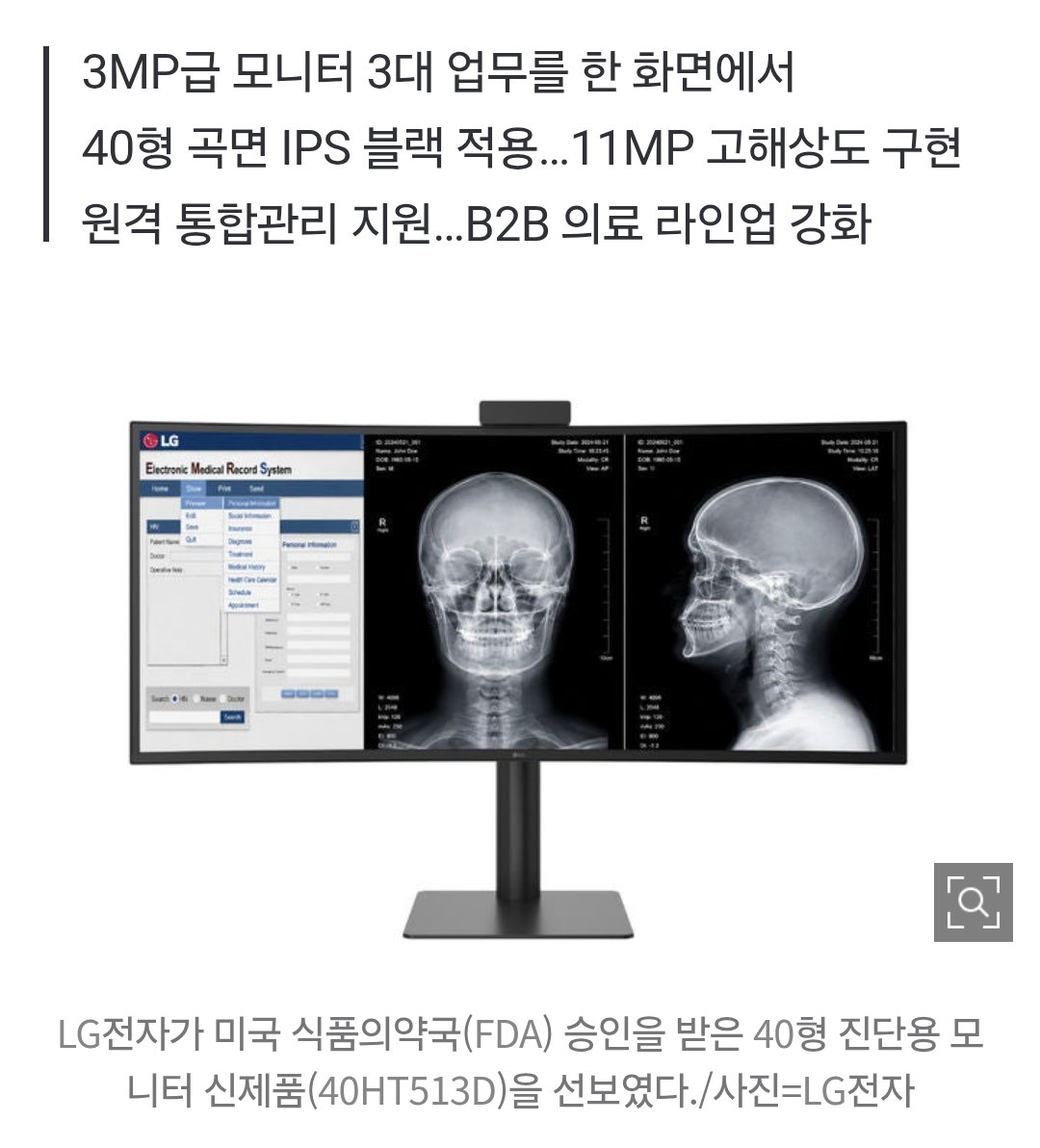OGPRPV