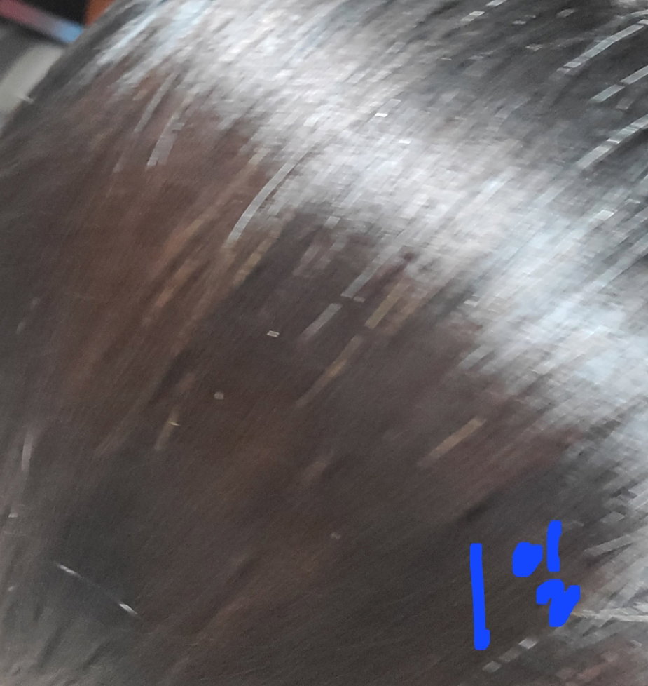 PwiXTK