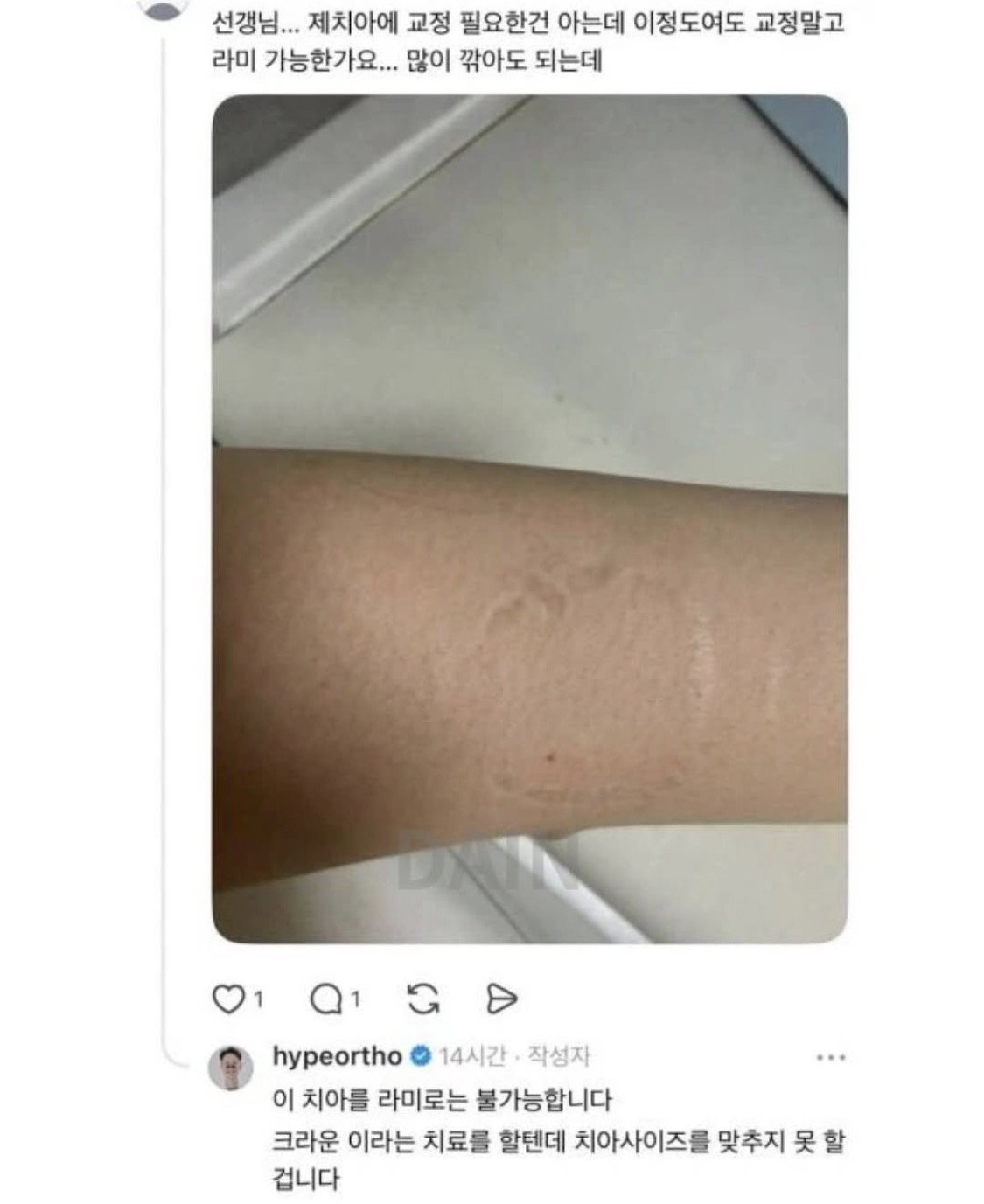 SUerMo