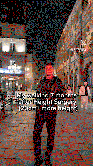 UgzPRE.gif