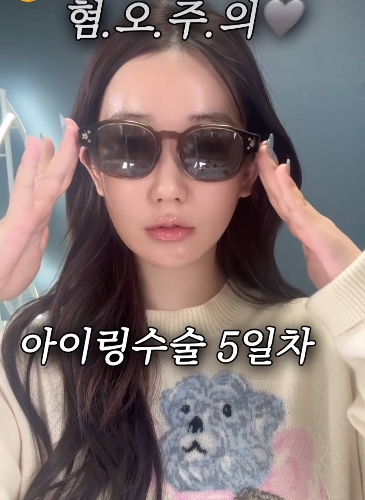 XUYUAb