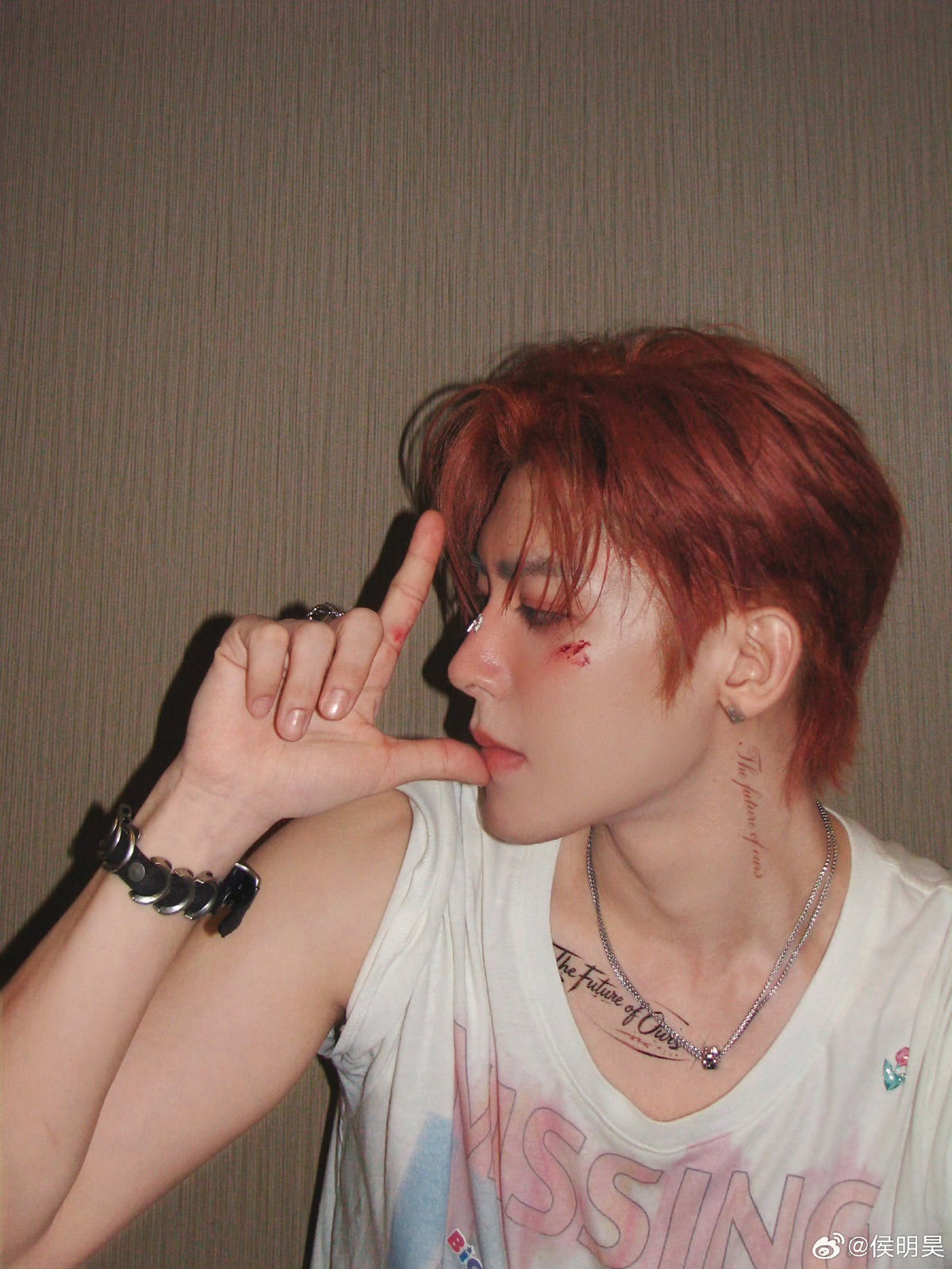 YLuipp