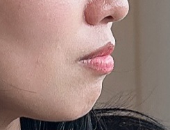 eLOPVU