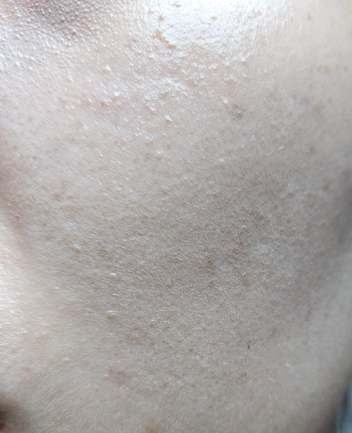 epOlEa