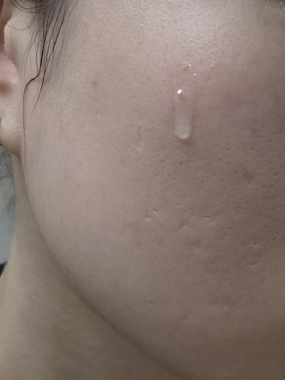 epSioy