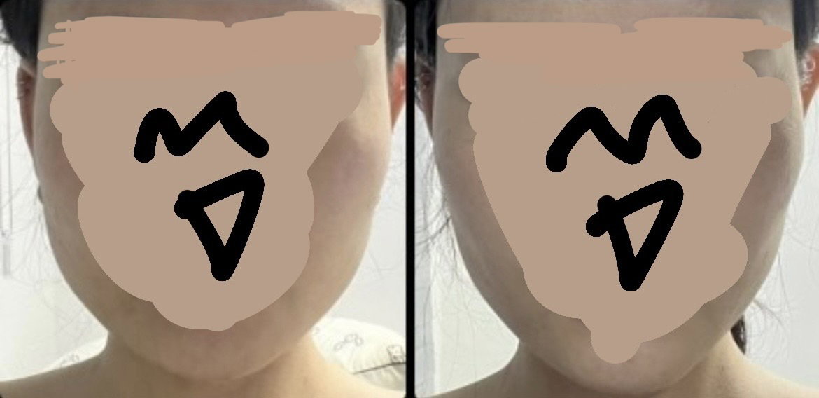 fTCGmE