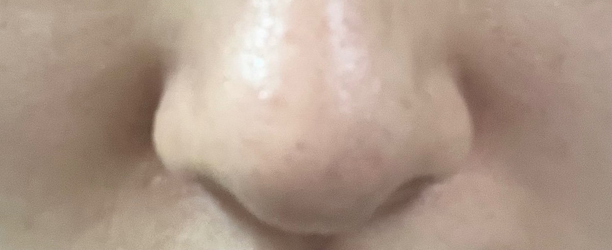 fepluk