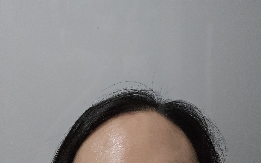 lfnRAD