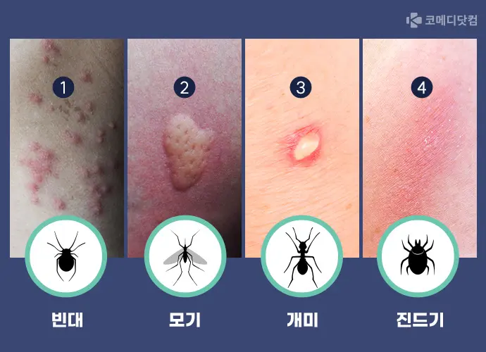 더쿠 - 집에서 벌레에 물렸는데 이 자국이 있다면 빈대 있는지 의심해봐야함