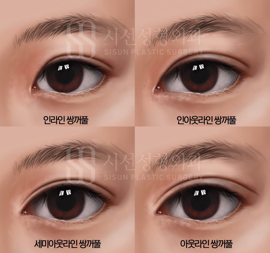 더쿠 - 덬배우는 쌍 (인/아웃/인아웃) vs 속쌍vs 무쌍 중에 뭐야???