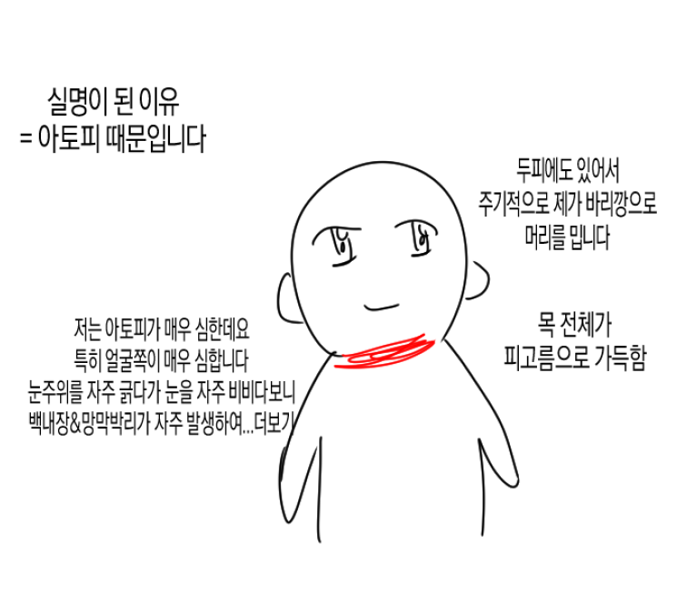 nYyPKW