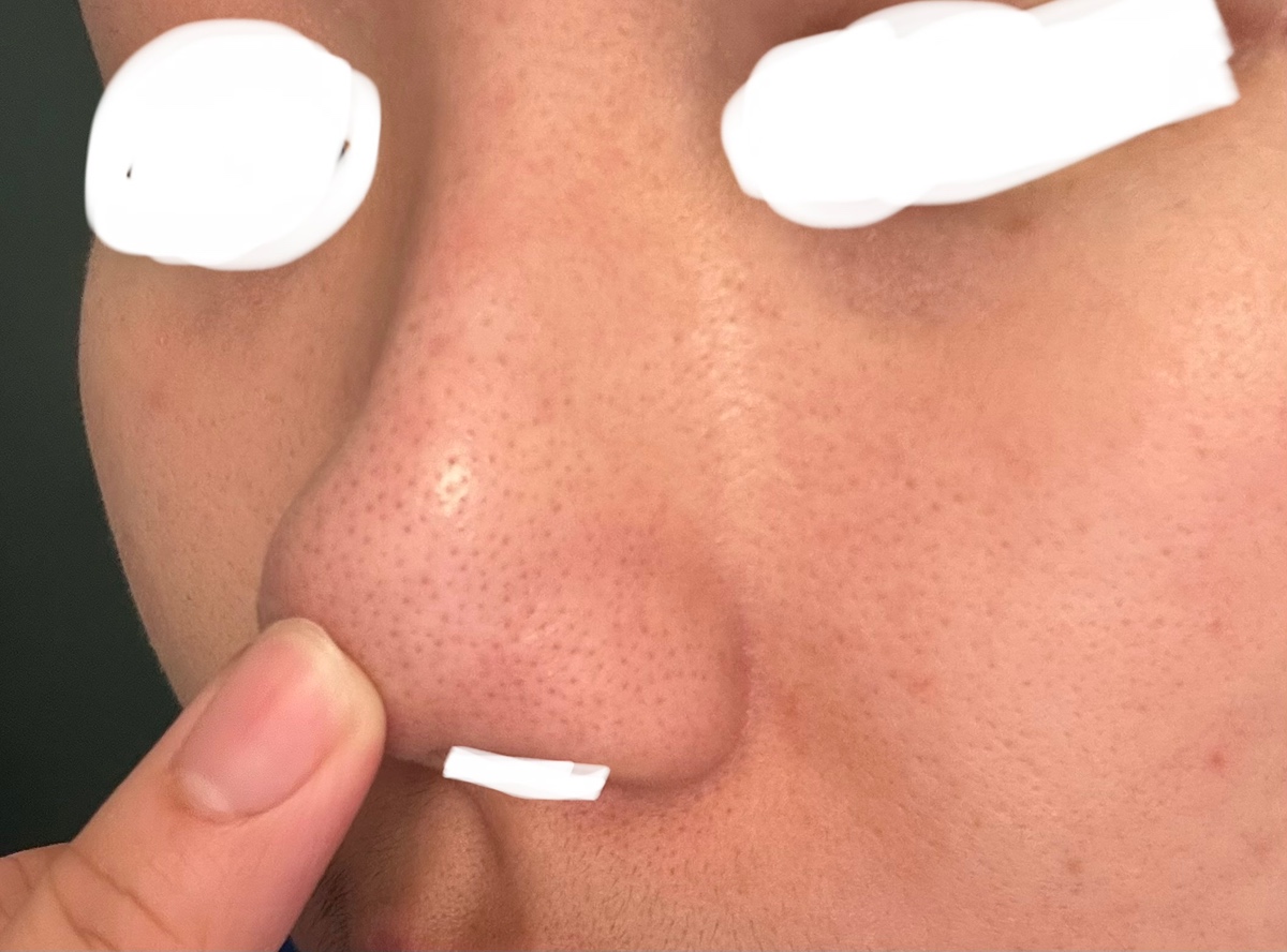 otvKjP