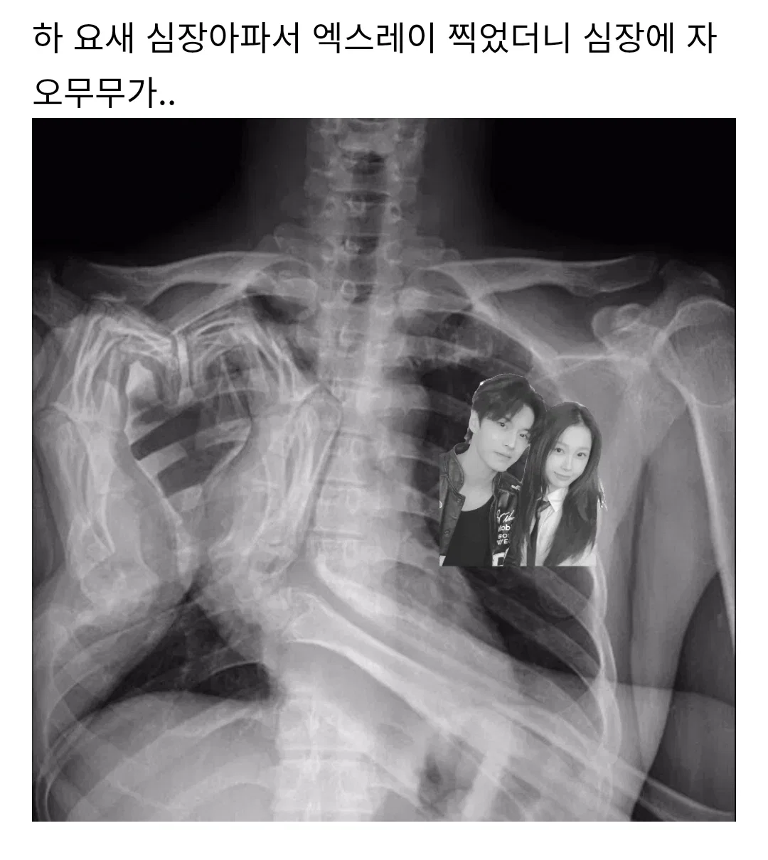 pCtJIP