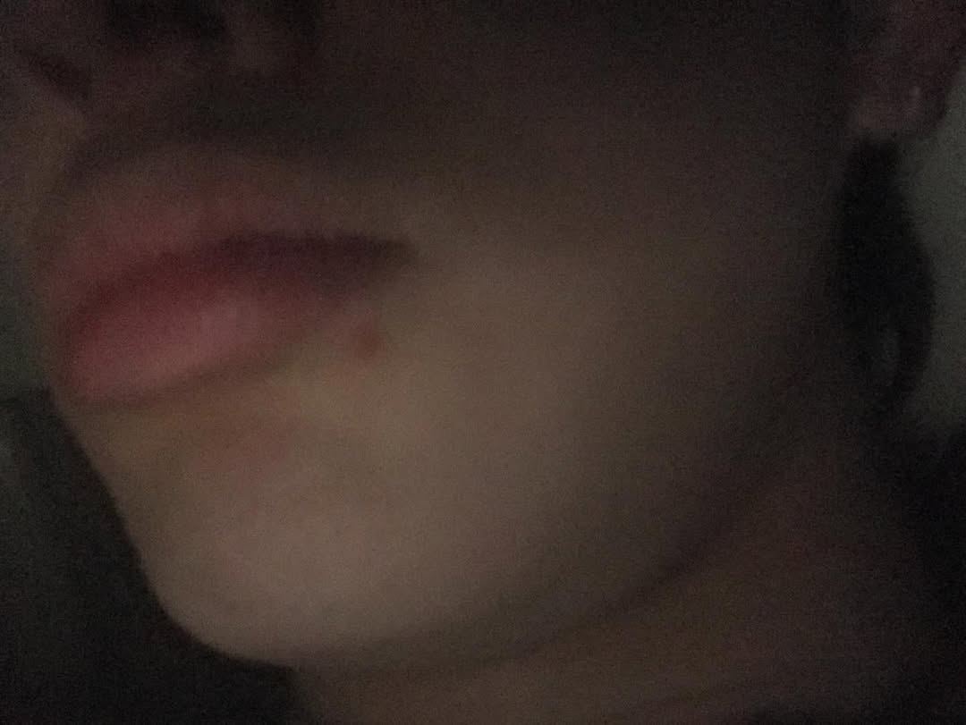 pHBGLx