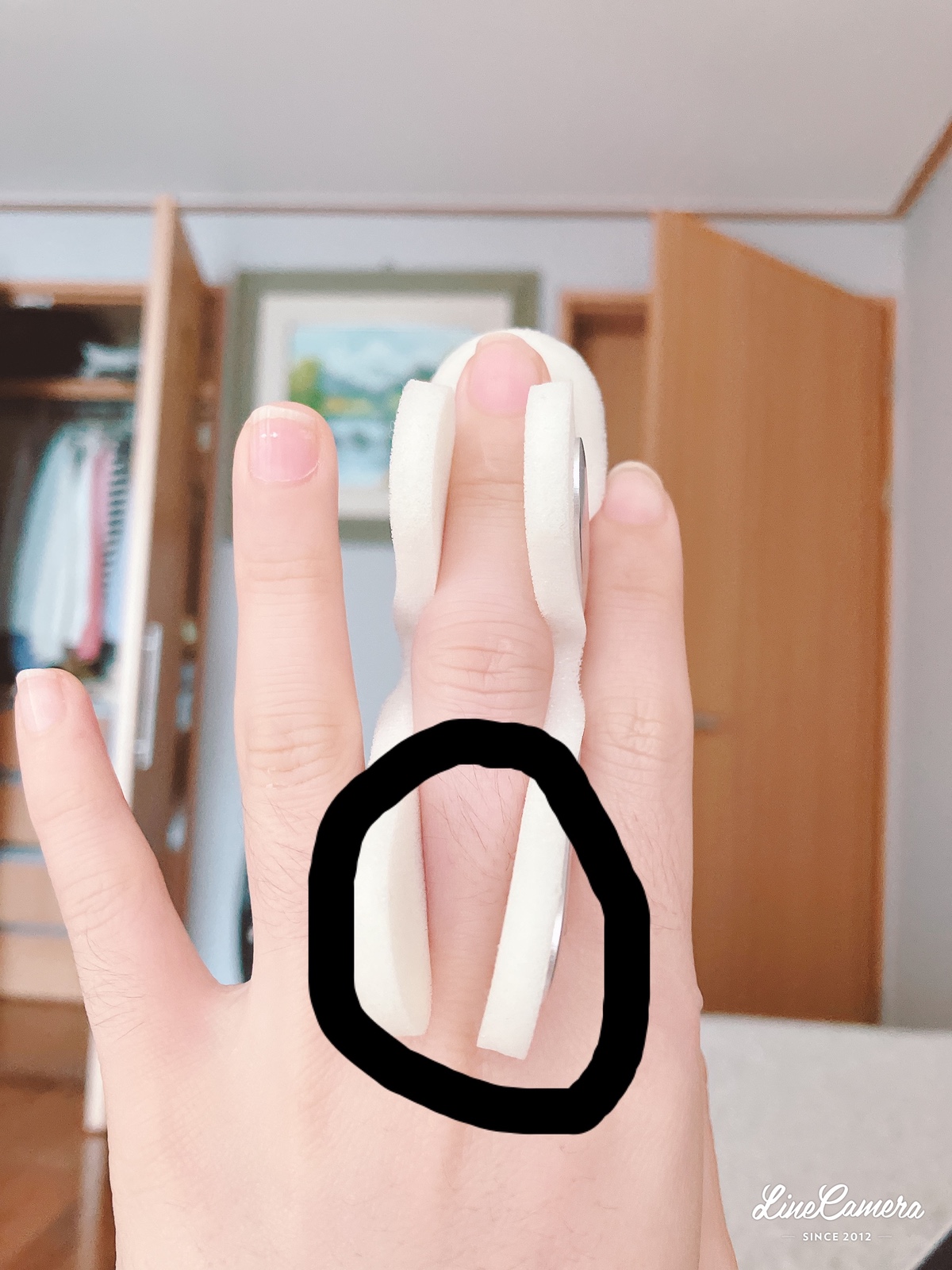 ㅇㅂㅌ) 손가락 다쳤다고 해야할지 오래가네