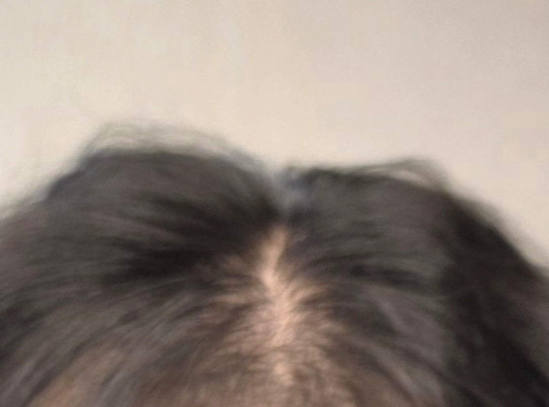 rdECiP