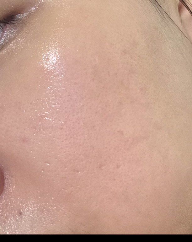 rnDYRU
