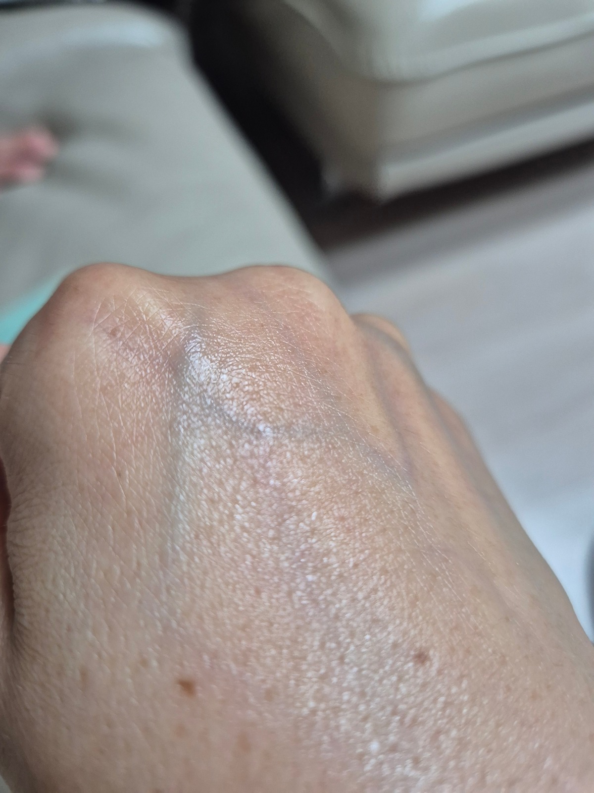 uoAXPA