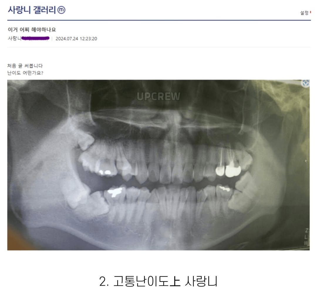 vbCnTc