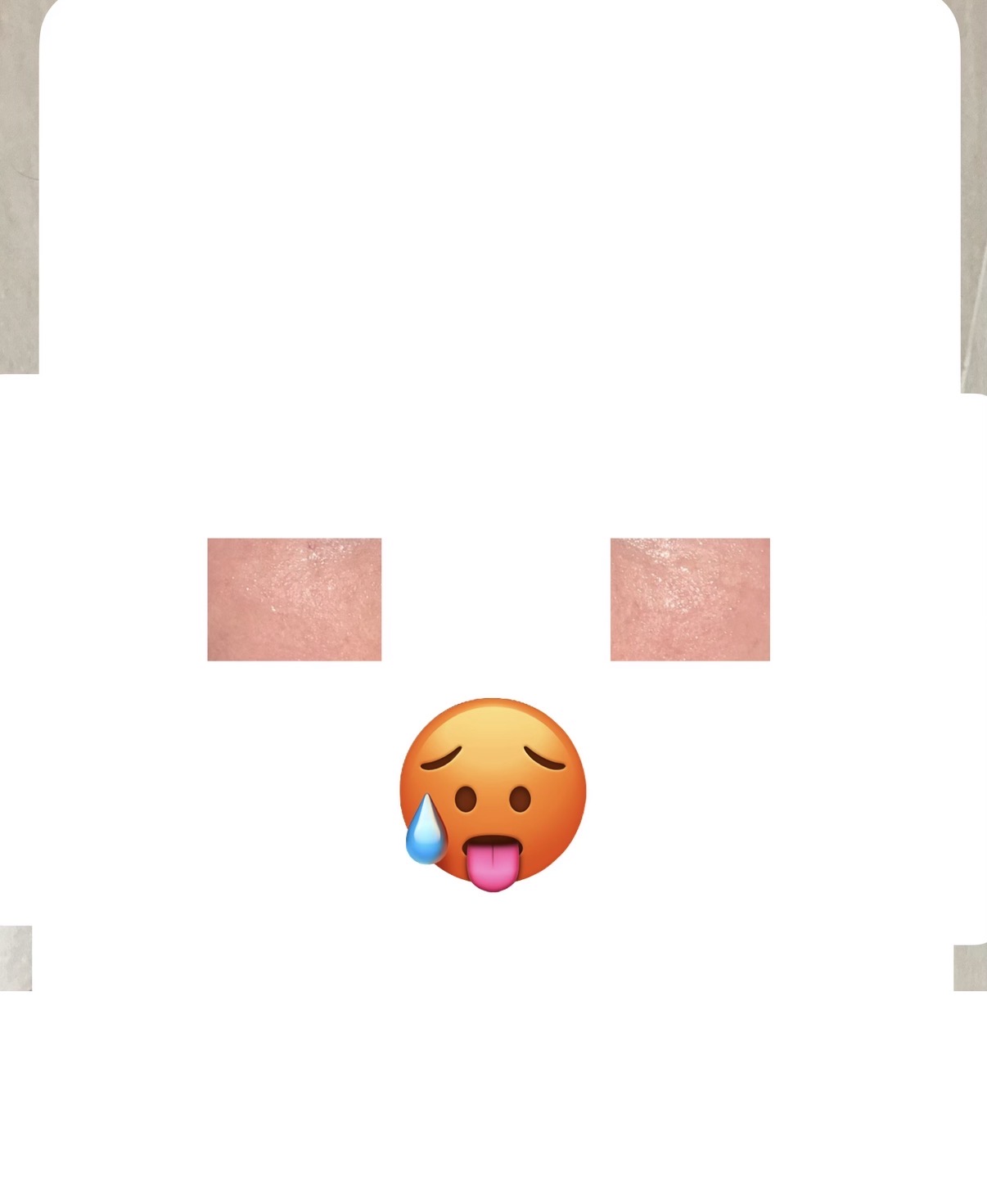 wVZacc